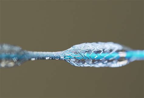 Nitinol: Matériau Allié Métallique Pour Des Applications Biomédicales Innovantes!